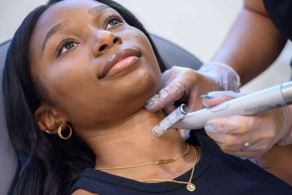 microneedling treatment in Toronto